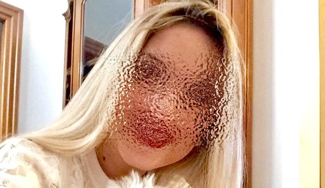 Η πρώτη ανατριχιαστική ανάρτηση της 34χρονης Ιωάννας μετά την επίθεση με βιτριόλι (Pics)