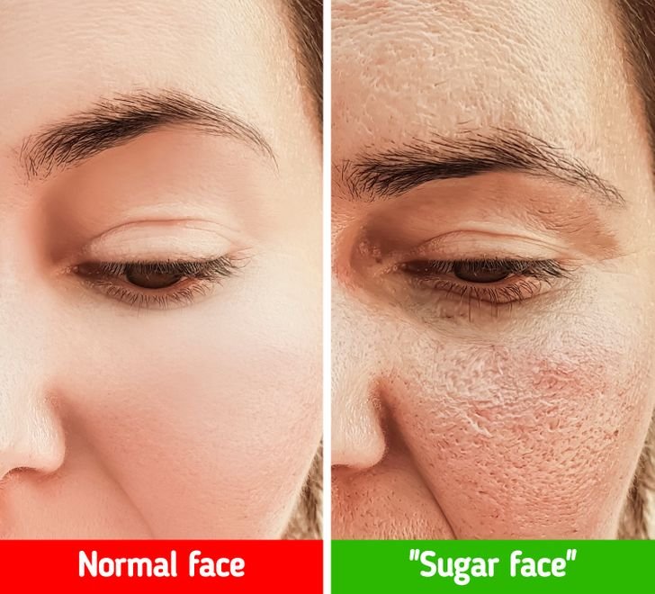 Οι 6 σημαντικές αλλαγές που θα δούμε εάν κόψουμε την ζάχαρη (εικόνες)