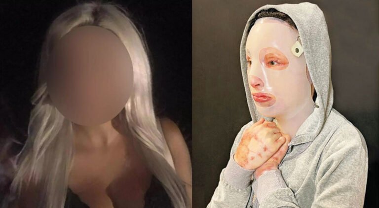 Επίθεση με βιτριόλι: Αυτός είναι ο 34χρονος συνεργός ( ; ) της βιτριολίστριας Έφης (Vid)