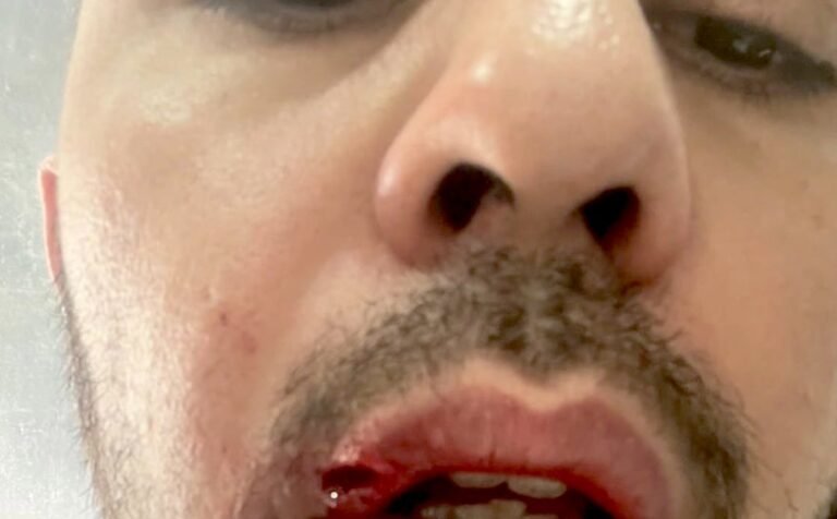 «Με χτύπησαν αλύπητα»: Παίρνει πίσω την ομολογία του ο επιχειρηματίας που κατηγορείται πως εμπλέκεται στον βιασμό 24χρονης (Pics)