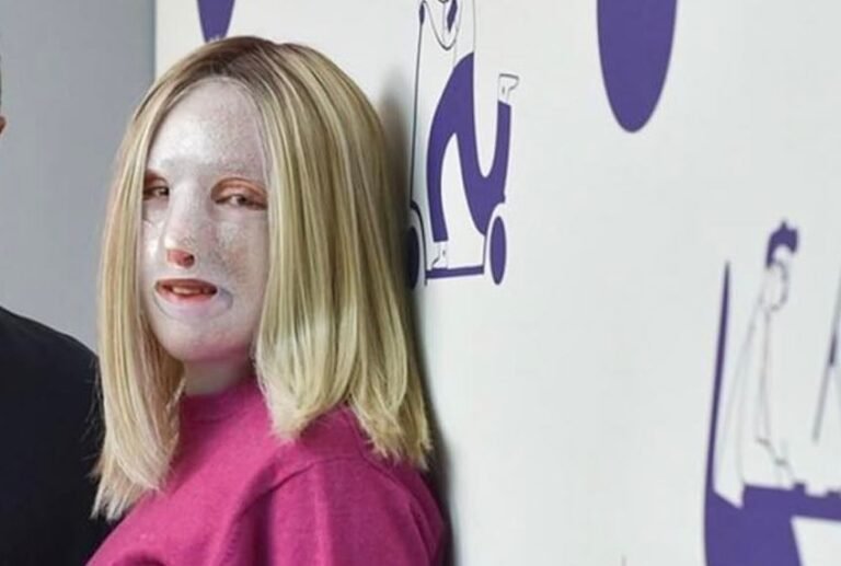 Συγκινεί η Ιωάννα Παλιοσπύρου: Η νέα συγκλονιστική φωτογραφία χωρίς τη μάσκα (Pic)