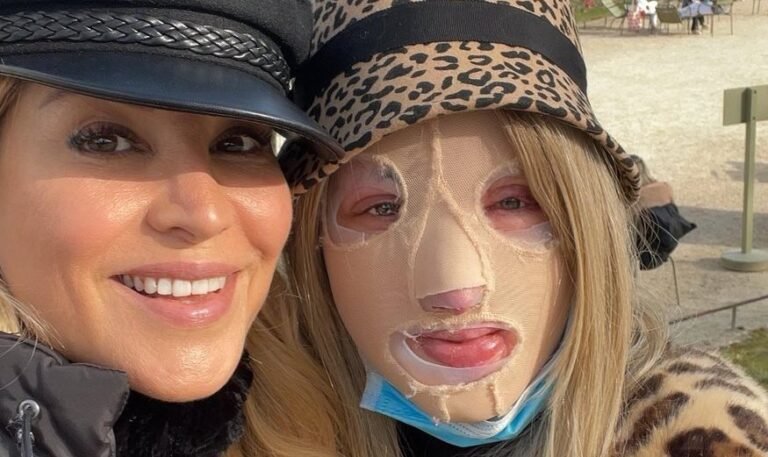 «Το χειρουργείο της δεν πήγε καλά»: Πολύ δυσάρεστη εξέλιξη για την Ιωάννα Παλιοσπύρου (Pic)