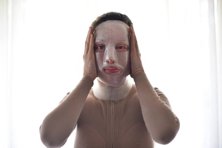 Όμορφη και χωρίς τη μάσκα: Η Ιωάννα Παλιοσπύρου δείχνει για πρώτη φορά το πρόσωπό της μετά την επίθεση με το βιτριόλι (Pics)