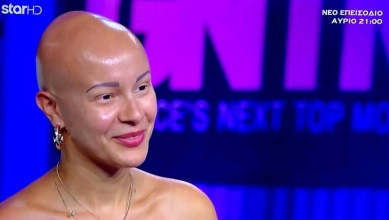 Νέα ζωή για τη Λυδία του GNTM – Πώς είναι 4 χρόνια μετά το κορίτσι που εντυπωσίασε τους πάντες (Pics)