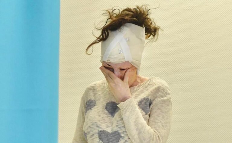 Σα να μην έγινε η επίθεση: Η Ιωάννα Παλιοσπύρου έκανε το απίστευτο στο πρόσωπό της – Η νέα της εικόνα (Pics)