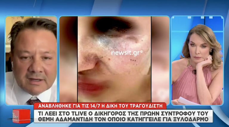 «Φαίνεται καθαρά ο Θέμης Αδαμαντίδης να τη χτυπά»: Oλόκληρο το βίντεο του ξυλοδαρμού της συντρόφου του τραγουδιστή (Vid)