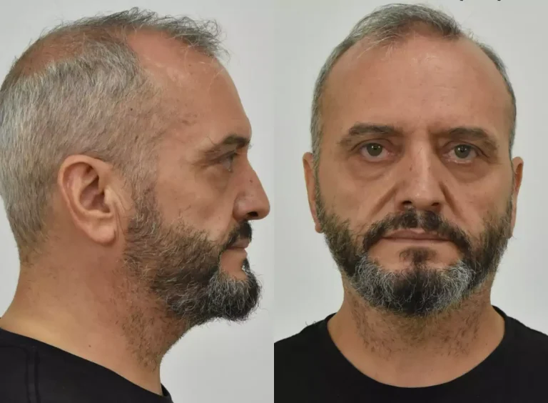 Παιδοβιαστές στον Κολωνό: Αυτοί είναι οι 2 άνδρες που κατηγορούνται – Η λίστα με τα 213 ονόματα που κάλεσαν για να βιάσουν τη 12χρονη (Pics)