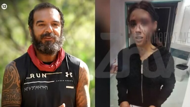 Θύμα άγριου ξυλοδαρμού η βαφτιστήρα του Τριαντάφυλλου από τον σύντροφό της – Σοκάρουν οι φωτογραφίες που κυκλοφόρησαν (Pics)