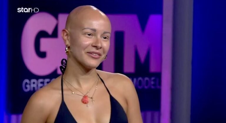 Μακριά μαλλιά, ομορφότερη απ’ όλες: Η Λυδία του GNTM αγνώριστη 4 χρόνια μετά το ριάλιτι (Pics)