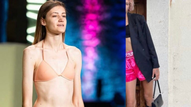 Σήμερα είναι πραγματικό μοντέλο:   7 χρόνια μετά είναι γυναικάρα και έχει προφιλ στο fans (pics)